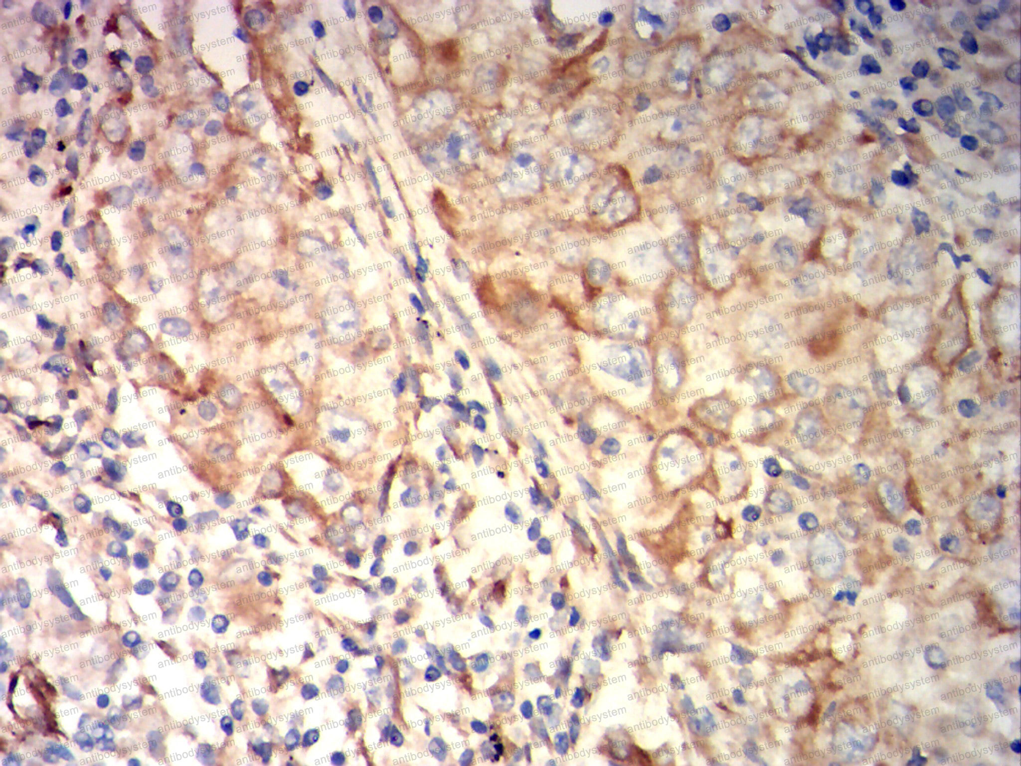 Валидация AntibodySystem RHG17901