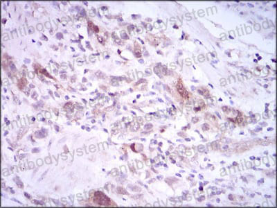 Валидация AntibodySystem RHE97404 (2410)