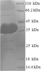 SDS-PAGE