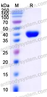 EHJ74101, SDS-PAGE