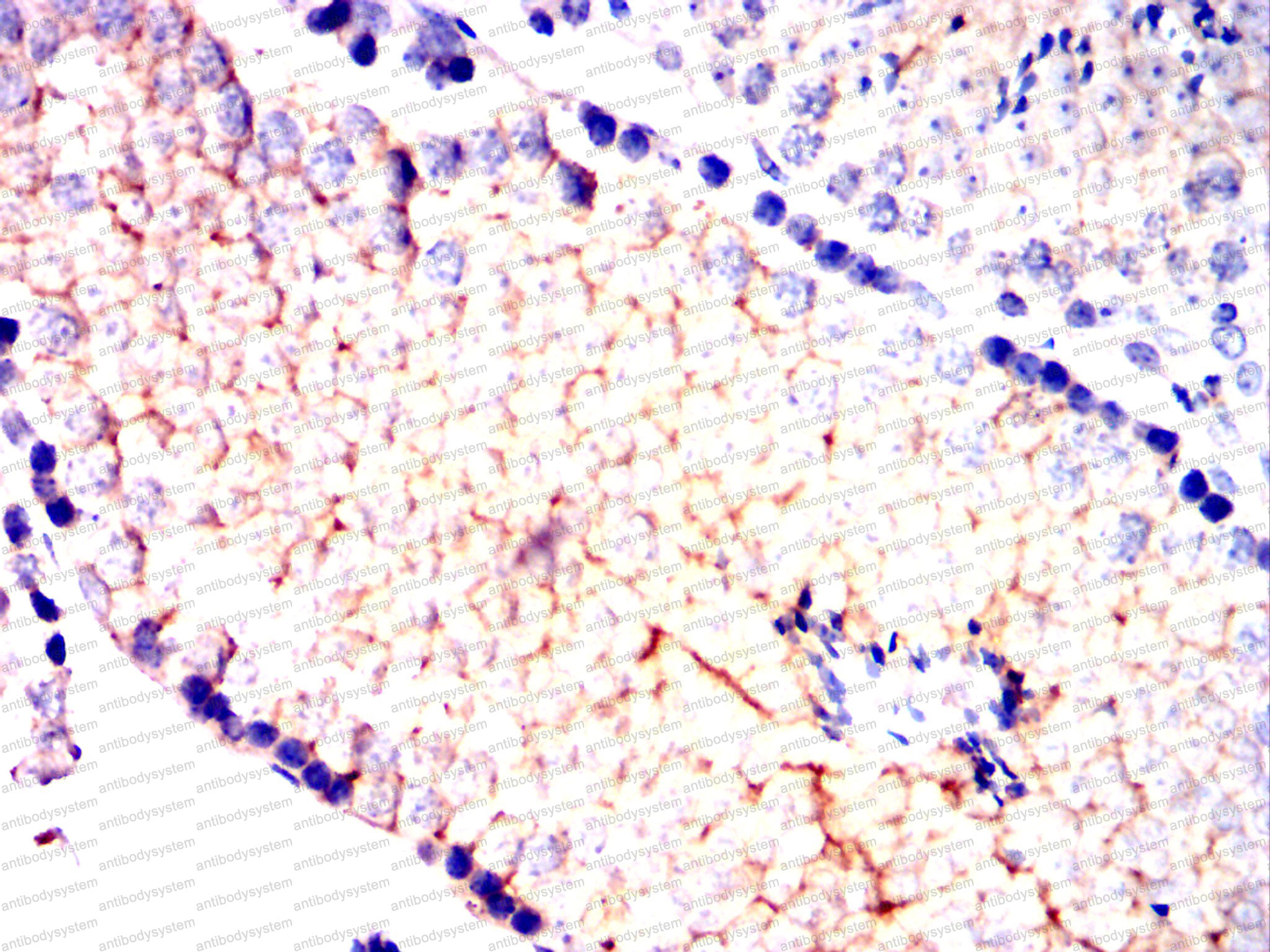 Валидация AntibodySystem RHD46601 (1590)