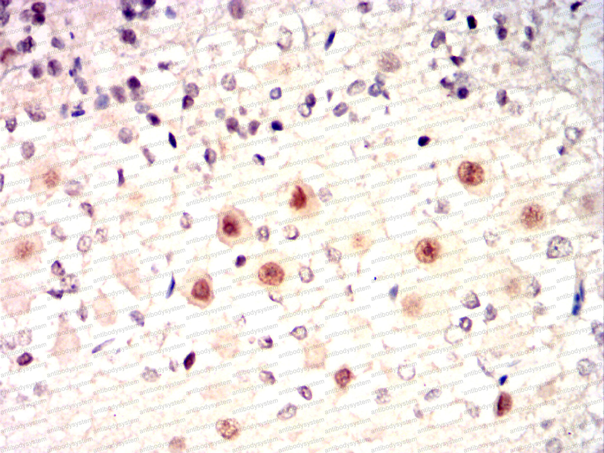 Валидация AntibodySystem RHJ52502