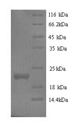 SDS-PAGE