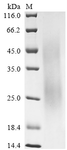 SDS-PAGE