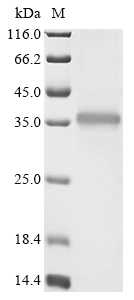 SDS-PAGE
