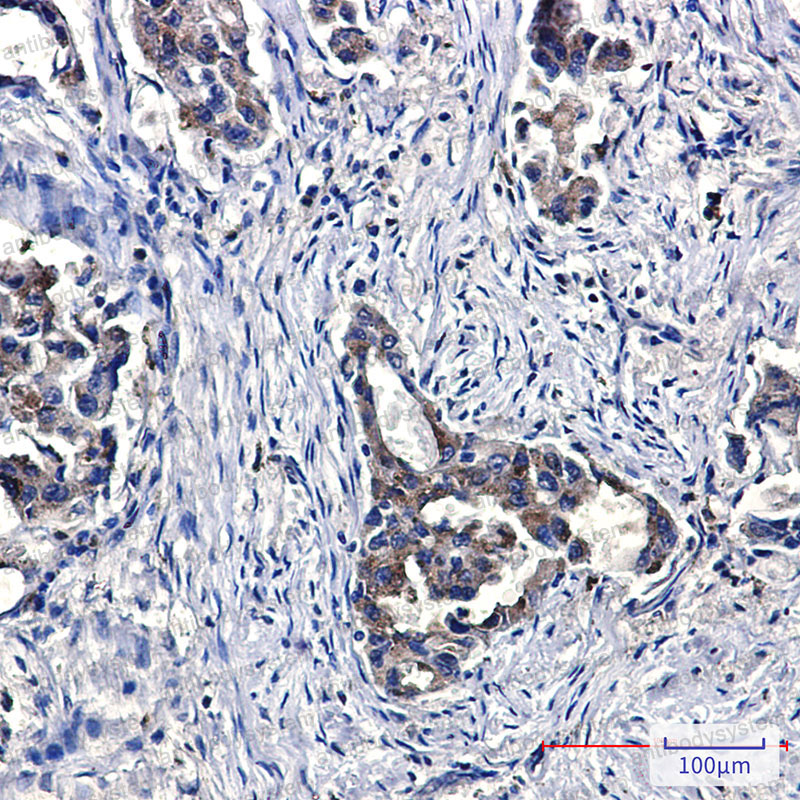 Валидация AntibodySystem RHF46401