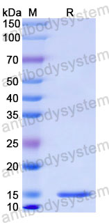 Валидация SDS-PAGE - AntibodySystem RHD55201