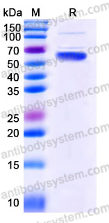 YHE08302, SDS-PAGE