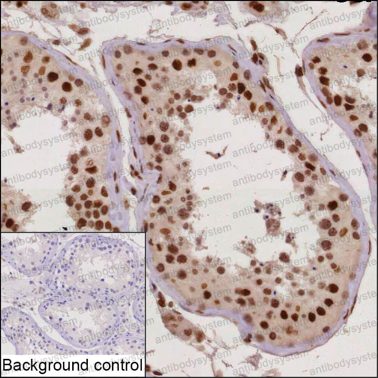 Валидация AntibodySystem RHB17203
