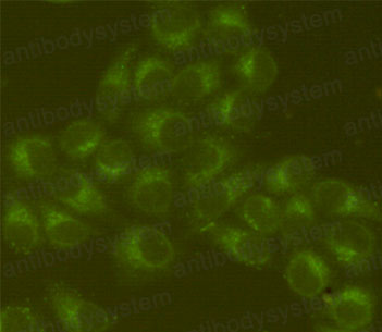 Валидация IF - AntibodySystem RHC84906