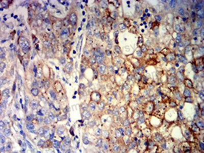 Валидация AntibodySystem RHD62203 (1678)