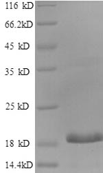 SDS-PAGE