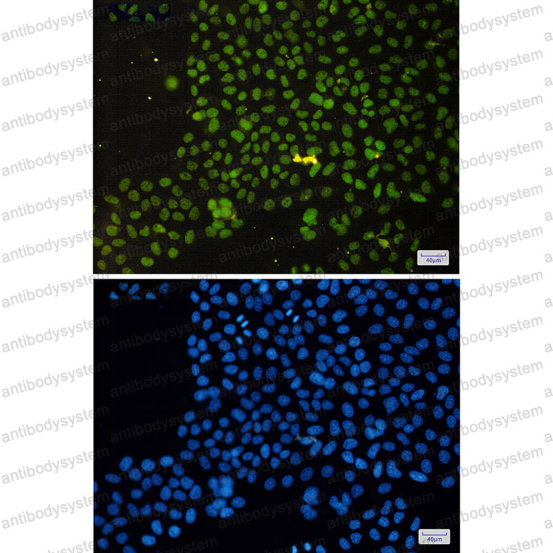 Валидация IF - AntibodySystem RHK65801