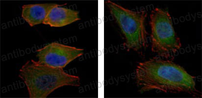 Валидация IF - AntibodySystem RHD96601