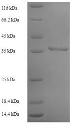 SDS-PAGE