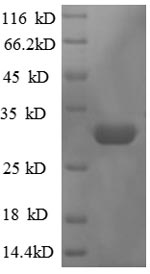 SDS-PAGE