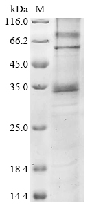 SDS-PAGE