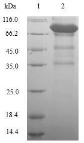 SDS-PAGE