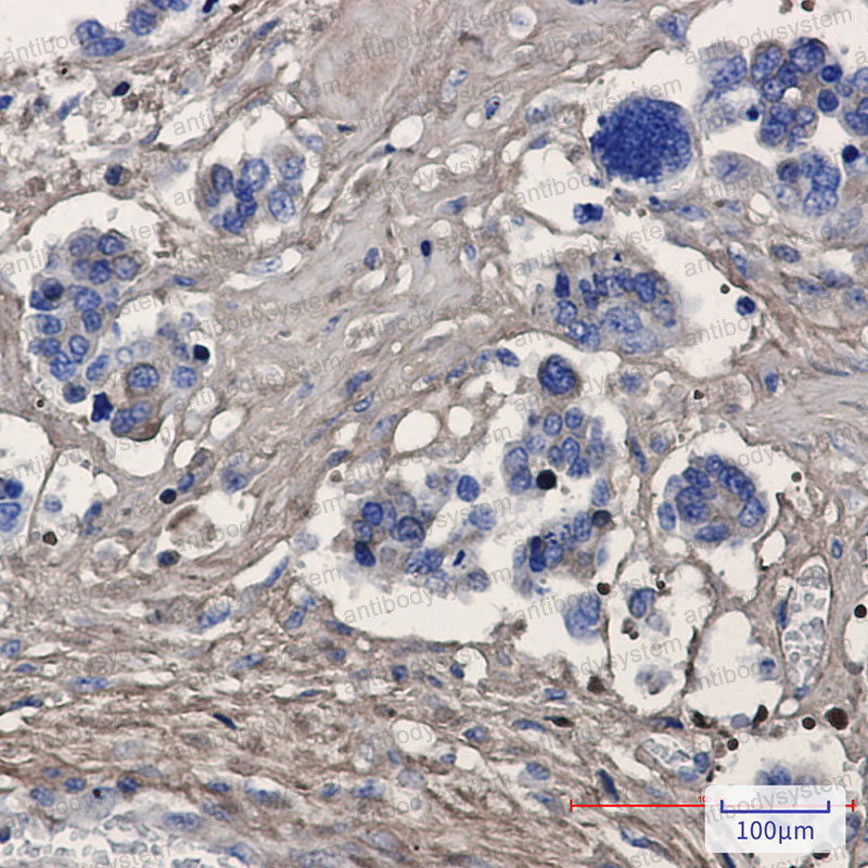 Валидация AntibodySystem RHH00906