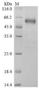 SDS-PAGE