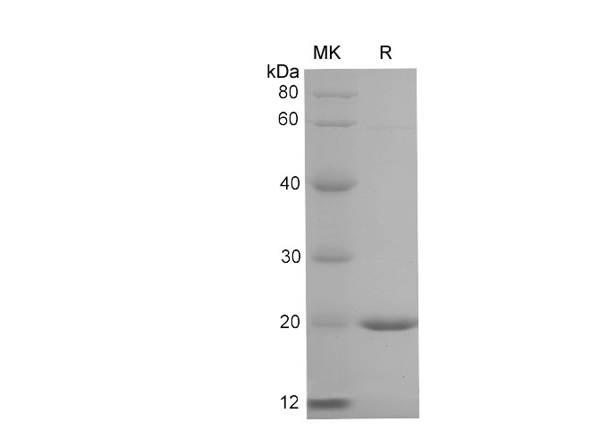 Валидация Elabscience PDEM100225(559)