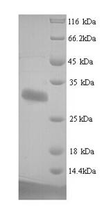 SDS-PAGE