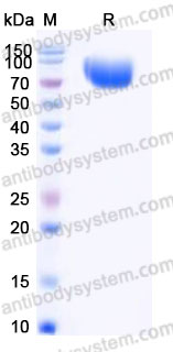 EHA51203, SDS-PAGE