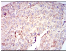 Валидация AssayVector ARM1716(2019)