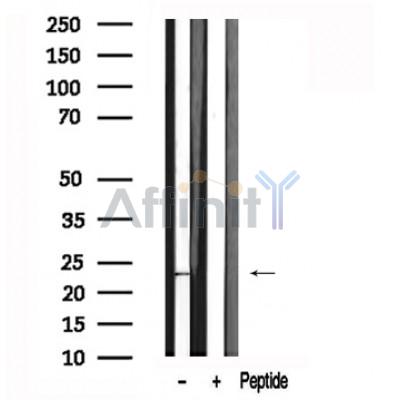 Валидация Affinity AF7575 - 4239