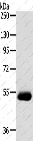 Вестерн-блоттинг, SERINC4, инфильтративная протоковая ткань молочной железы человека