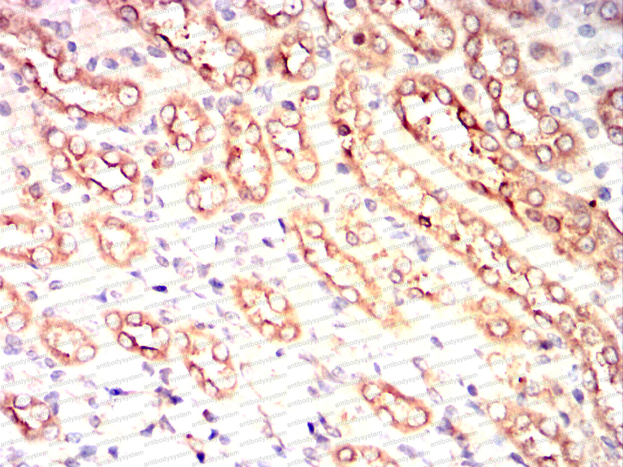 Валидация AntibodySystem RHD53604 (1635)