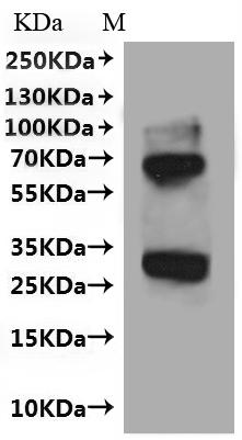 SDS-PAGE