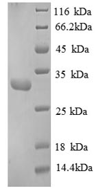 SDS-PAGE