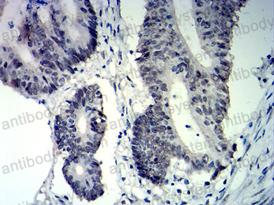 Валидация AntibodySystem RHE73803
