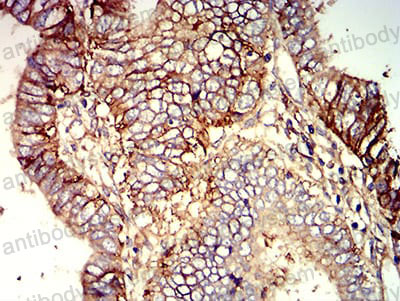 Валидация AntibodySystem RHJ04004