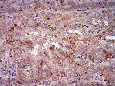 Валидация AntibodySystem RMN92903