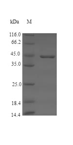 SDS-PAGE