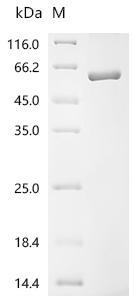 SDS-PAGE