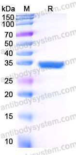 YHC06202, SDS-PAGE