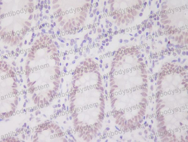 Валидация AntibodySystem RHC28301