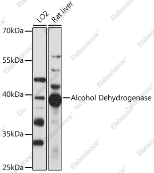 Вестерн-блоттинг, Alcohol Dehydrogenase, различные клеточные линии