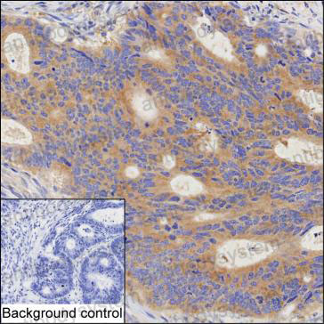 Валидация AntibodySystem RHD26202