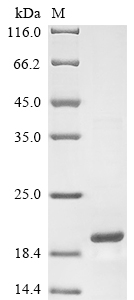 SDS-PAGE