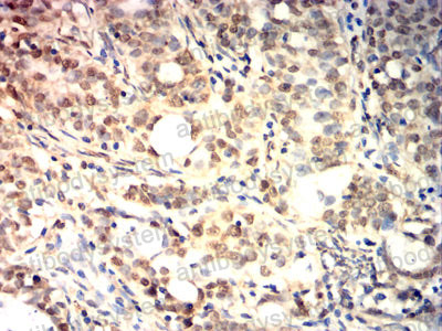 Валидация AntibodySystem RHD31502 (1470)