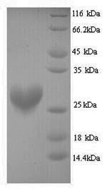 SDS-PAGE