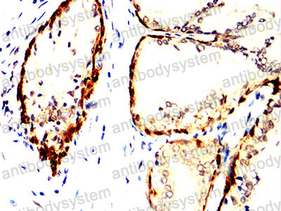 Валидация AntibodySystem RHD50801 (1620)
