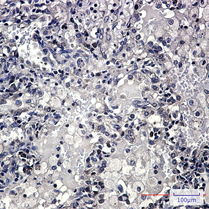 Валидация AntibodySystem RHH23801