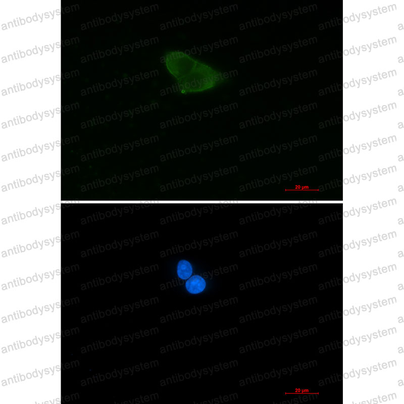 Валидация IF - AntibodySystem RHE70801