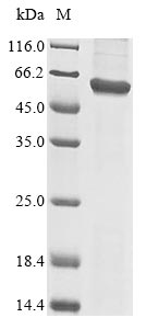 SDS-PAGE