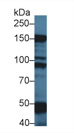 9581